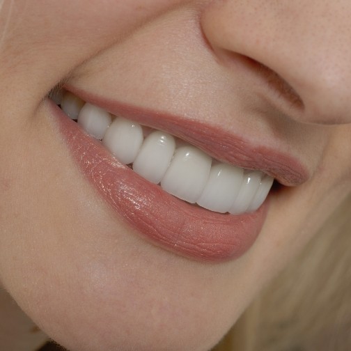 Close up of woman smiling with straight white teeth