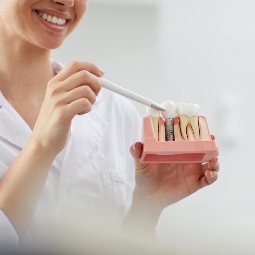 Dentist showing a dental implant model to a patient