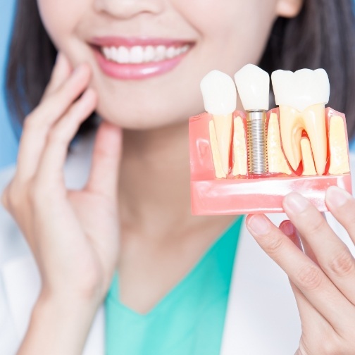 Smiling dentist holding a model of a dental implant