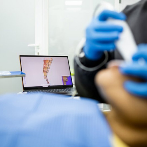 Dentist using an intraoral scanner that is displaying images of the patient’s mouth on a computer in the background