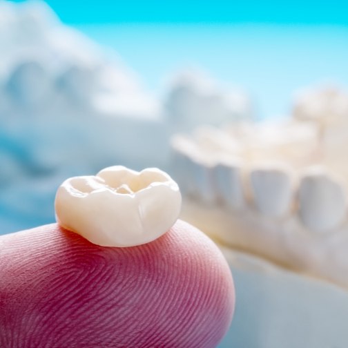 Dental crown resting on a finger