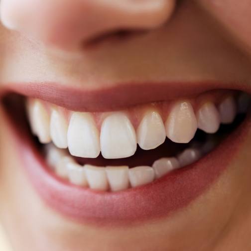 Close up of person smiling with flawless teeth