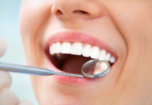 Keller dentist Dr. Sheri McIntosh offers periodontal therapy so you can have teeth and gums that are strong and healthy. 
