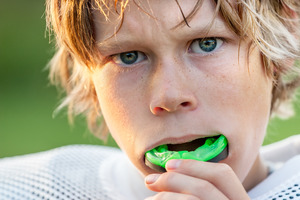 Young boy putting in an athletic mouthguard