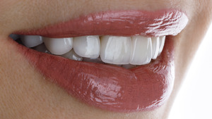 Close-up of a smile with bright white teeth