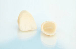 Close-up of two dental crowns lying on a reflective surface
